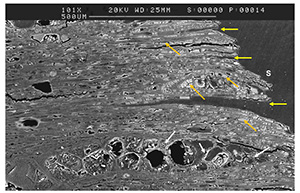 ÉTUDE MICROSCOPIQUE DE LA SURFACE